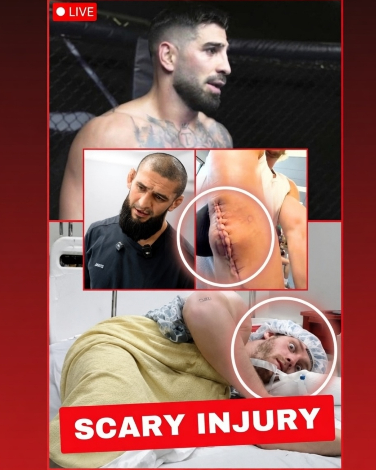 The MMA world has just plunged into absolute horror! 🥊 Rising megastar Khamzat Chimaev has reportedly suffered a near-fatal, catastrophic injury inside the Octagon, leaving the entire stadium in a traumatic hush!