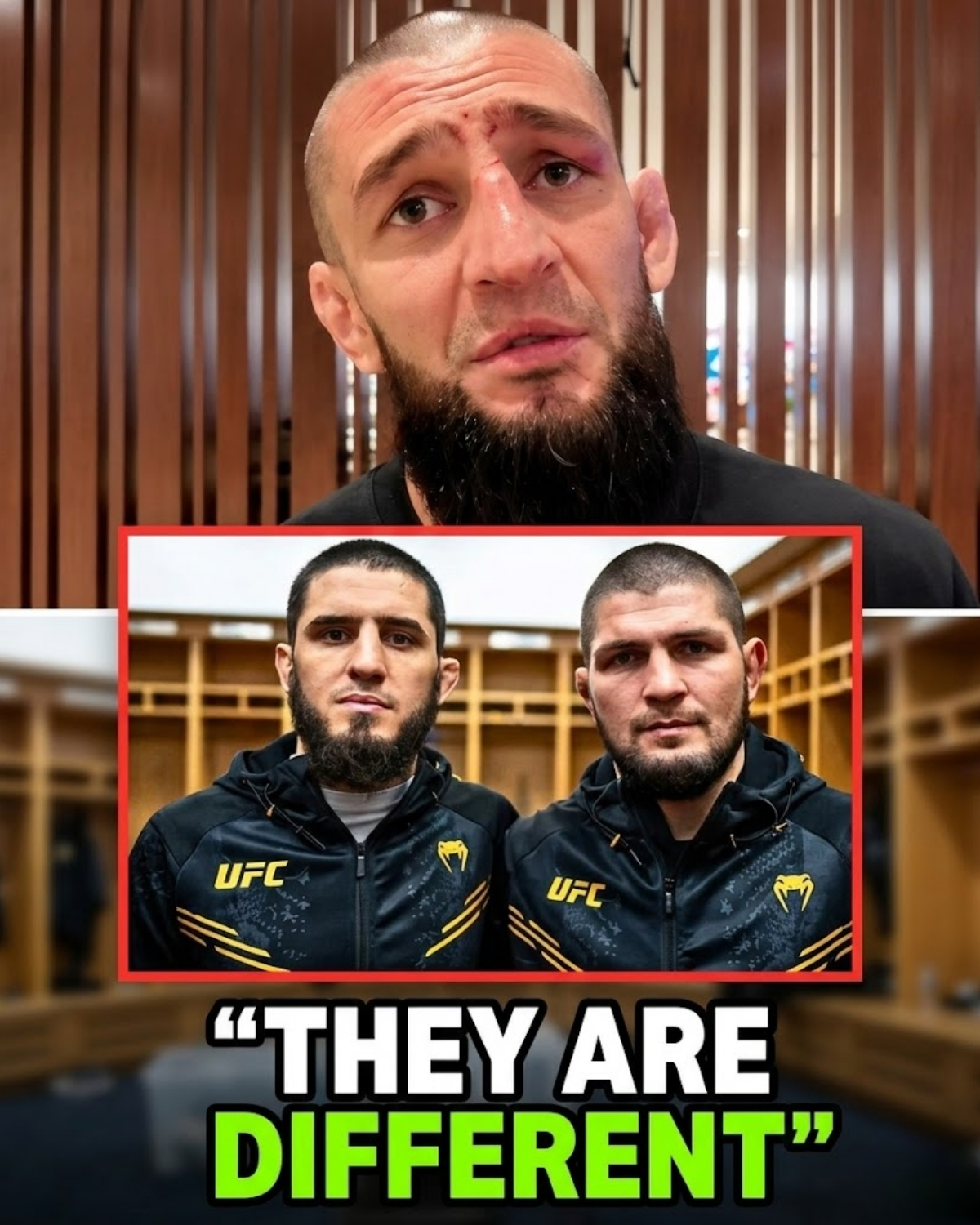 The “Wolf” is tired of being in the shadows! ๐บ Khamzat Chimaev just dropped a bombshell regarding those legendary comparisons to Khabib and Islam Makhachev. ๐ฑ Is he following their path, or is there a hidden rivalry brewing behind the scenes?
