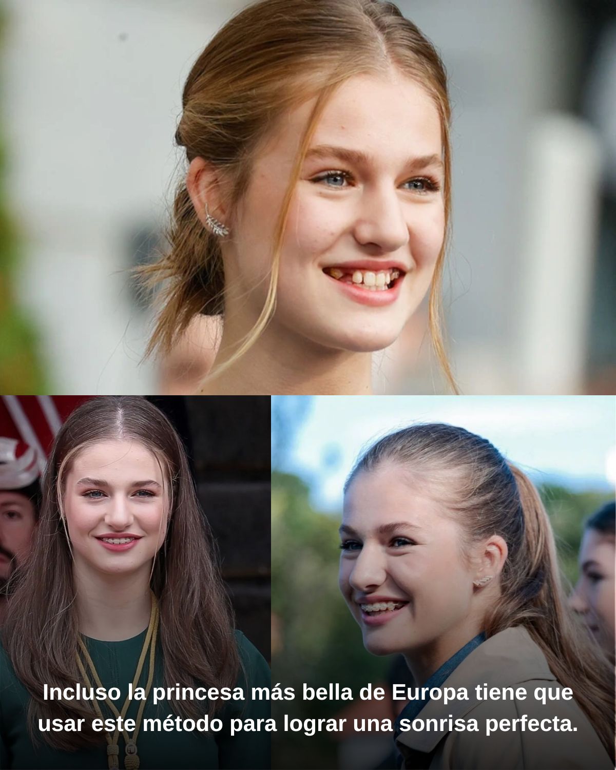 Incluso la princesa mรกs bella de Europa tiene que usar este mรฉtodo para lograr una sonrisa perfecta.